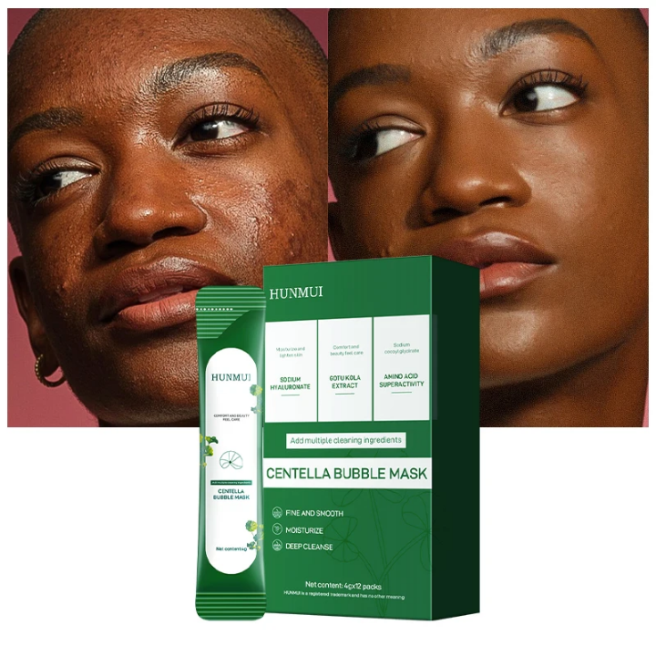 🔥Masque Facial de visage à bulles, mousse purifiante🔥