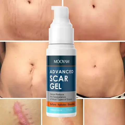 Gel de cicatrise