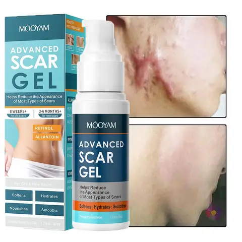 Gel de cicatrise