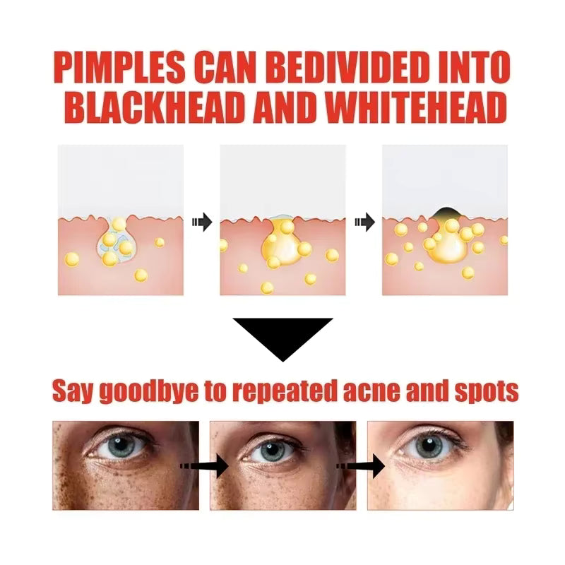 Pommade exfoliant