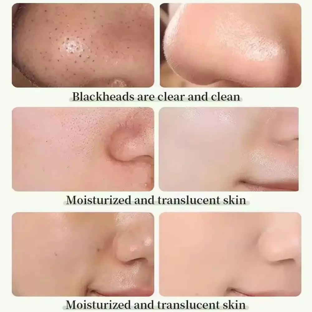 🔥Masque Facial de visage à bulles, mousse purifiante🔥
