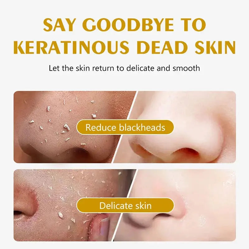 Gel Exfoliant